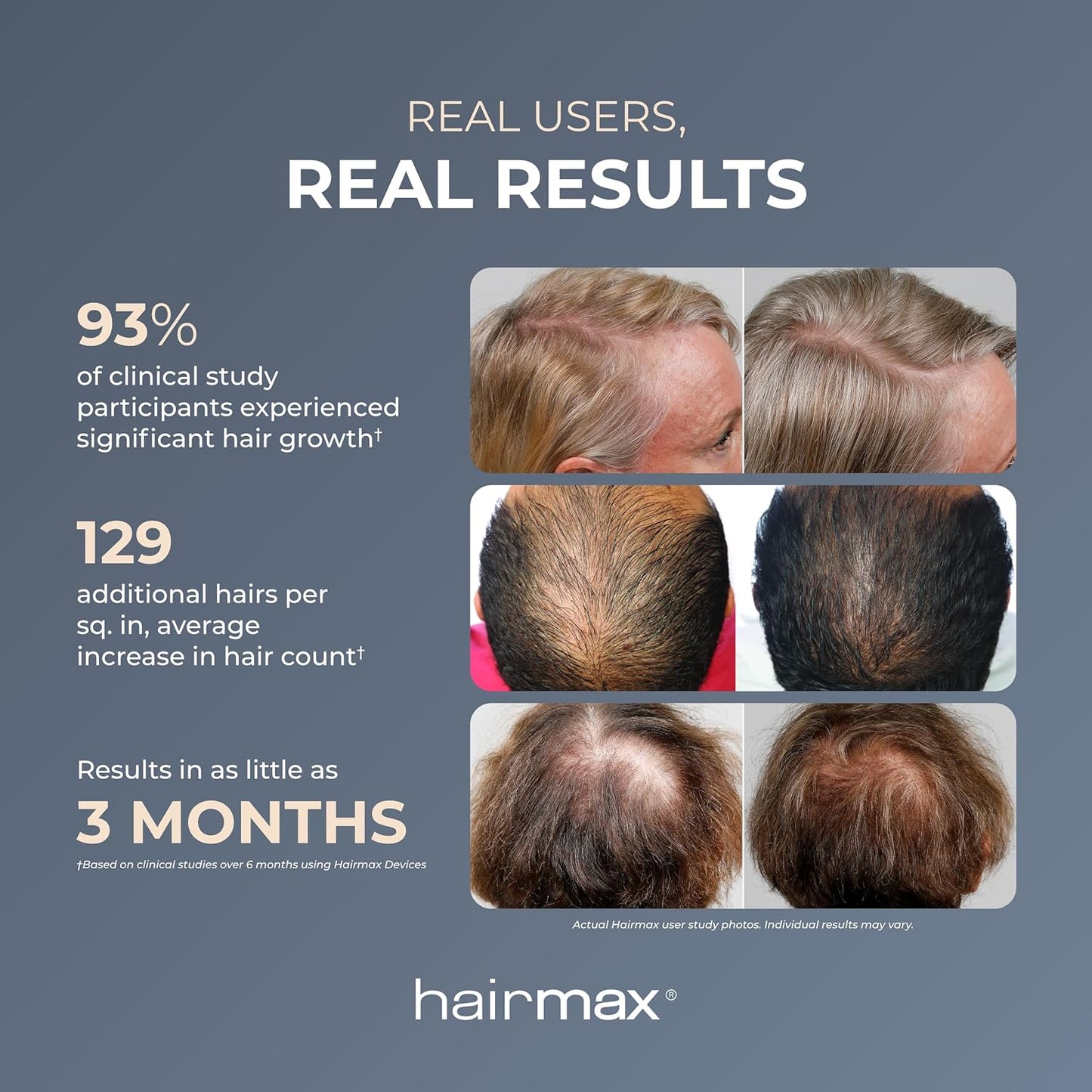 HairMax ULTIMA 12 LaserComb - Stimulates Hair Growth, Reverses Thinning, Regrows Fuller More Vibrant Hair