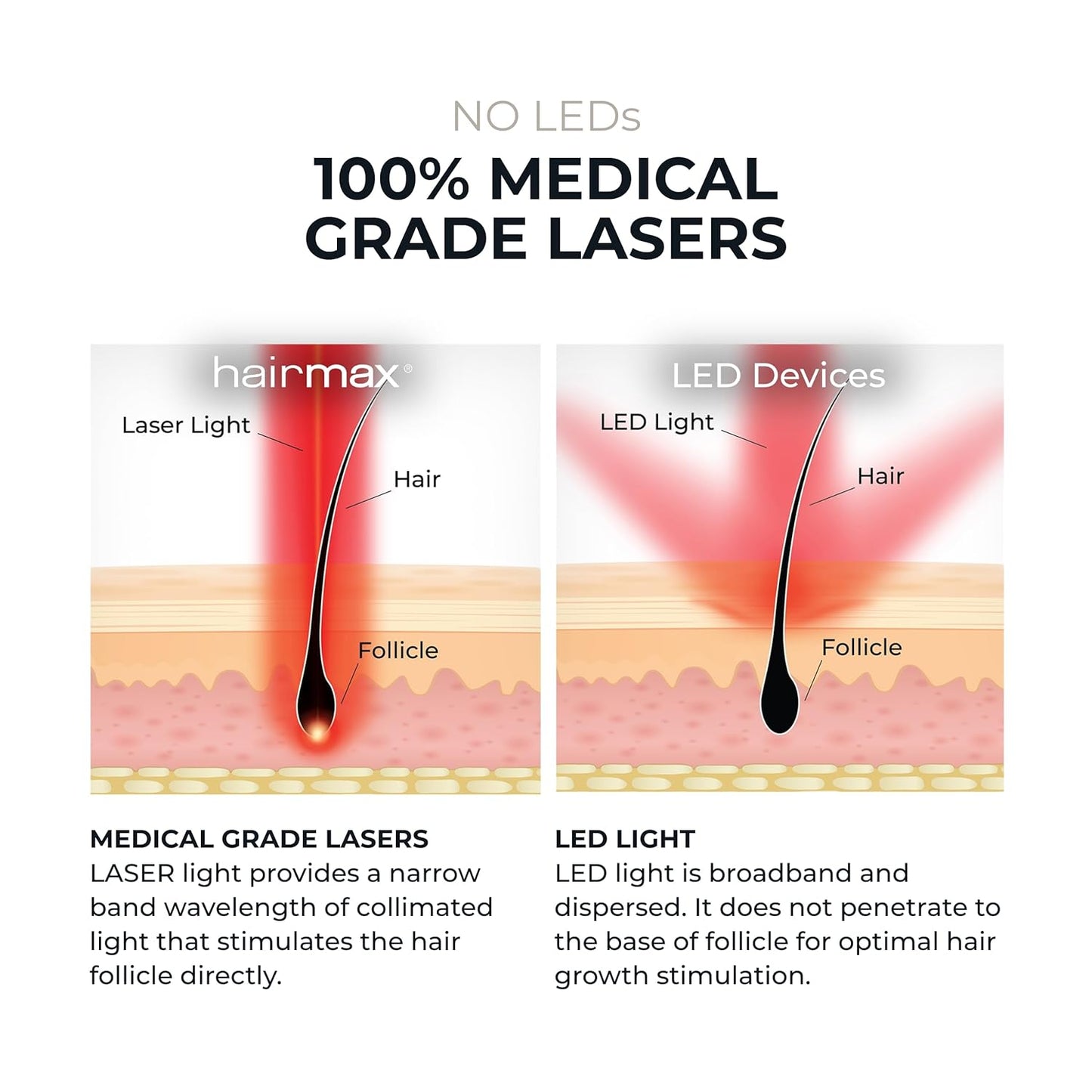 HairMax ULTIMA 12 LaserComb - Stimulates Hair Growth, Reverses Thinning, Regrows Fuller More Vibrant Hair