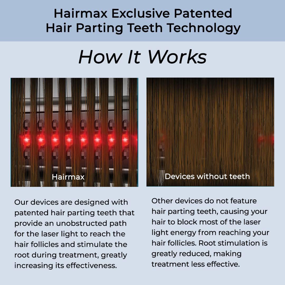 HairMax ULTIMA 12 LaserComb - Stimulates Hair Growth, Reverses Thinning, Regrows Fuller More Vibrant Hair